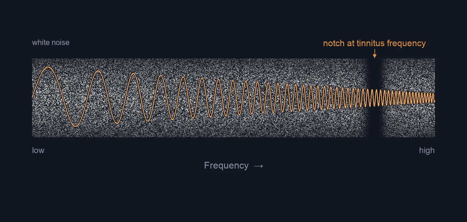 Diagram of audio notching: a band of white noise with a narrow notch removed around the tinnitus frequency